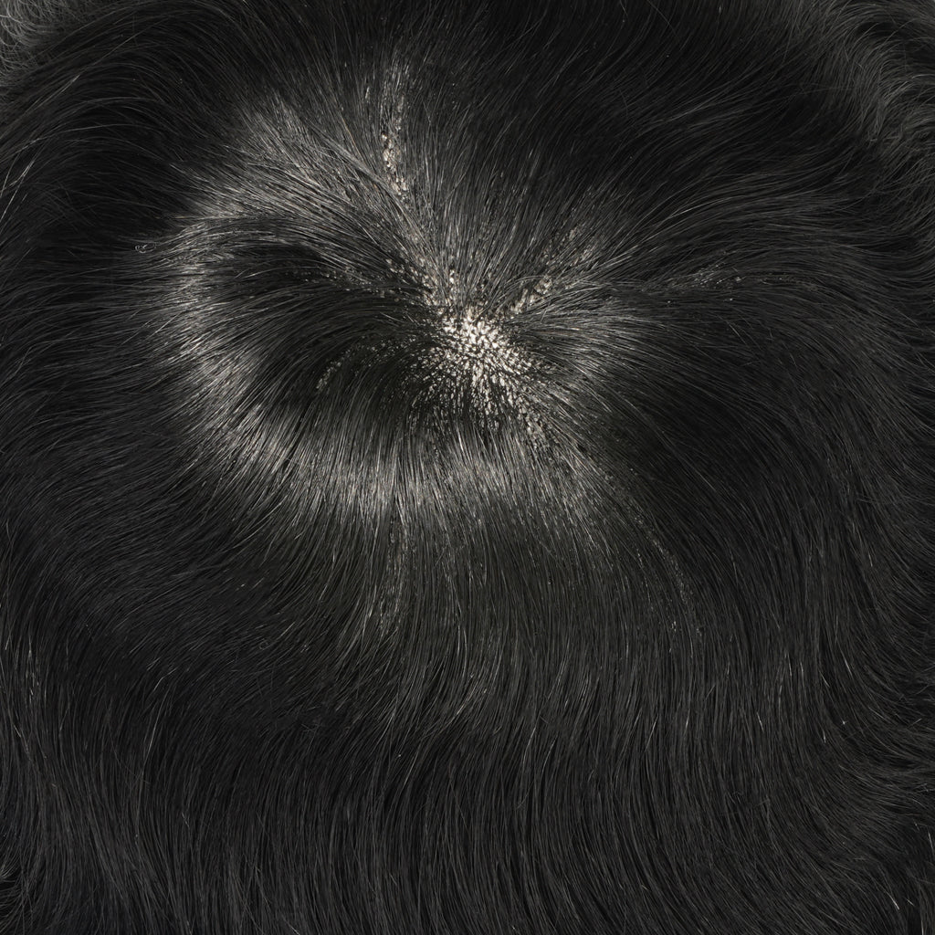 Supple-P gallery photo 4